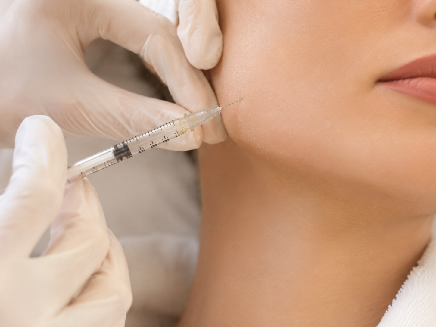 Rejuvenecimiento facial - imagen 1
