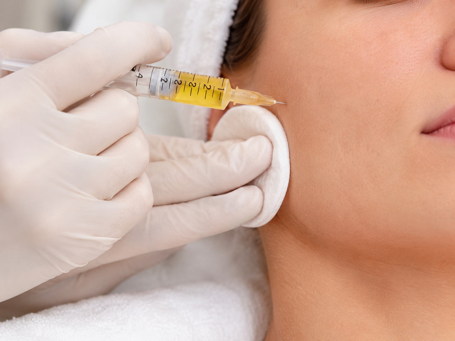 Plasma facial - imagen 3