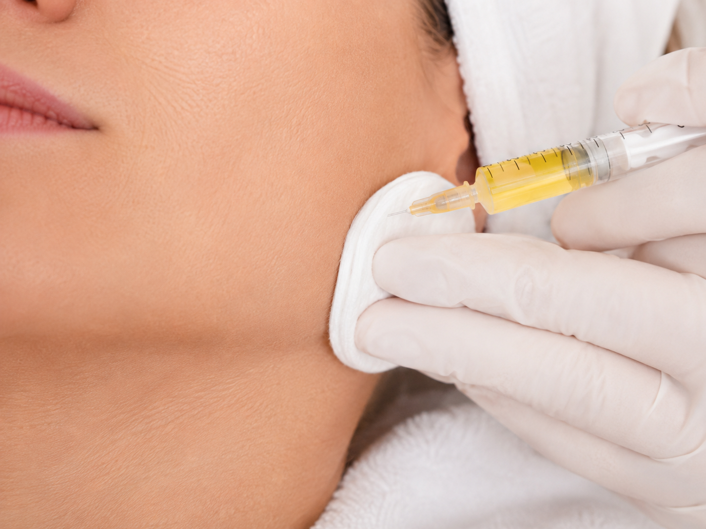 Plasma facial - imagen 1