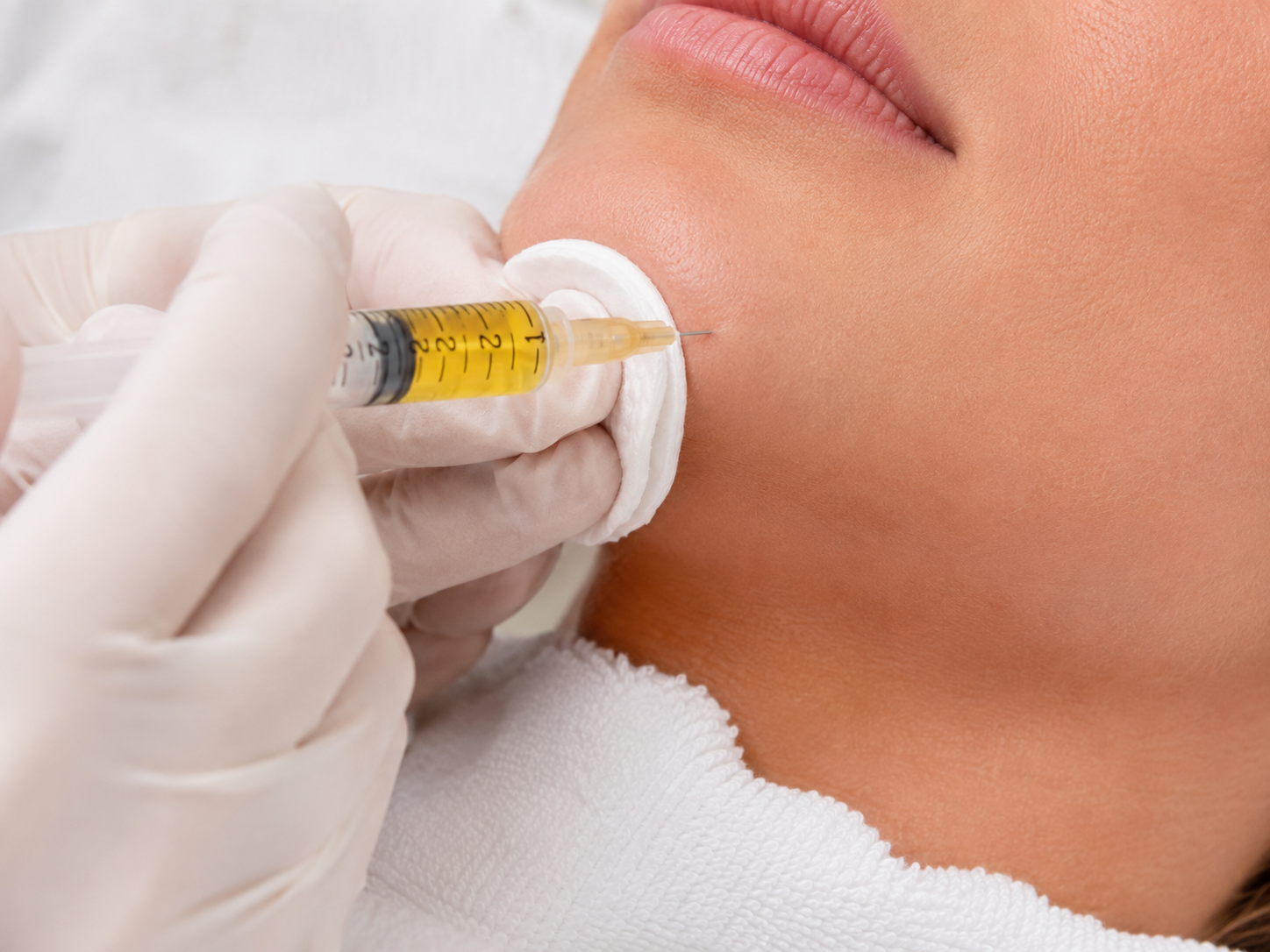 Plasma facial - imagen 2
